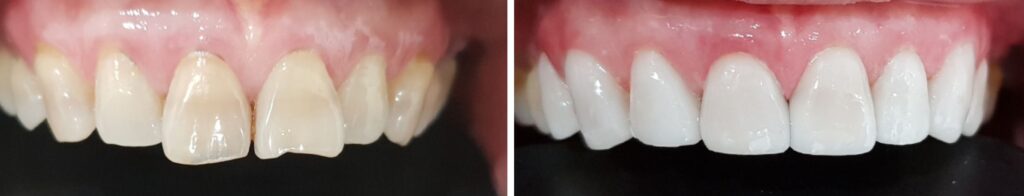 smile design dentistry in boston